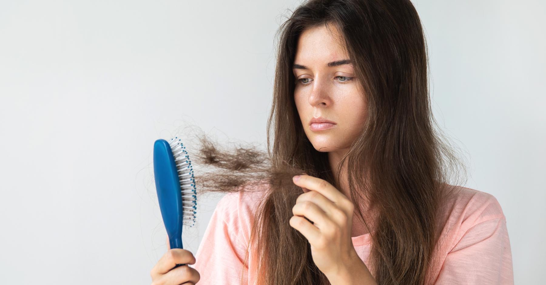 PCOS Hair Loss