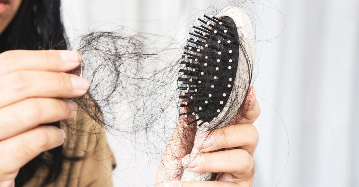 Hormonal Hair Loss in Women