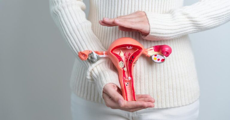 Ovarian Cancer