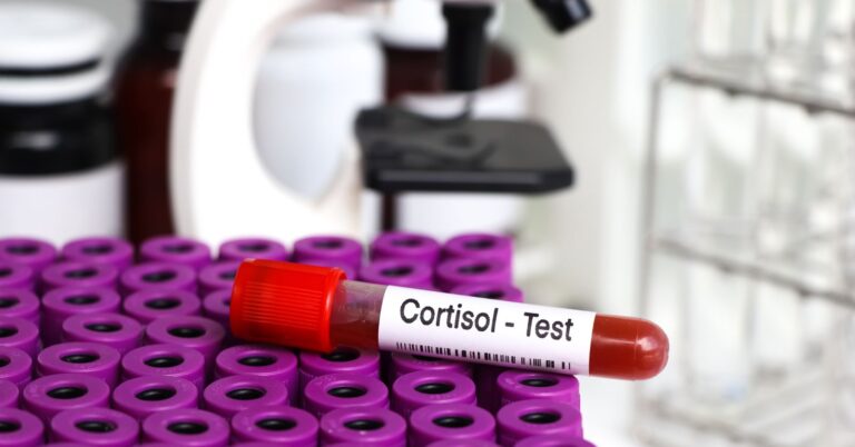 Track Cortisol Levels at Home