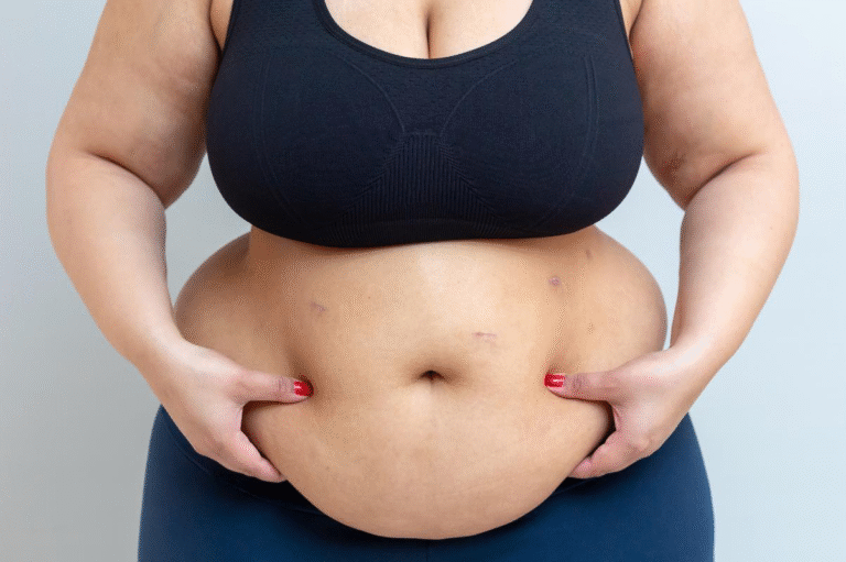 Belly Fat Won’t Go Away