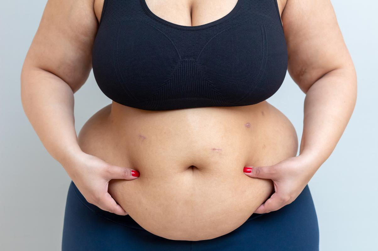 Belly Fat Won’t Go Away