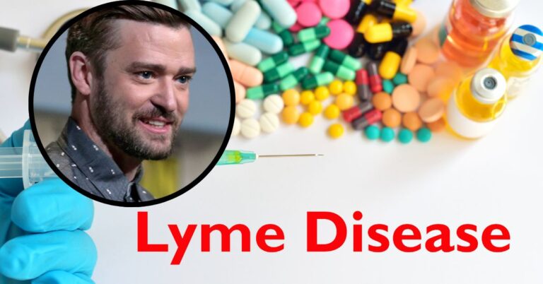 Justin Timberlake’s Lyme Diagnosis: Key Symptoms & Treatment