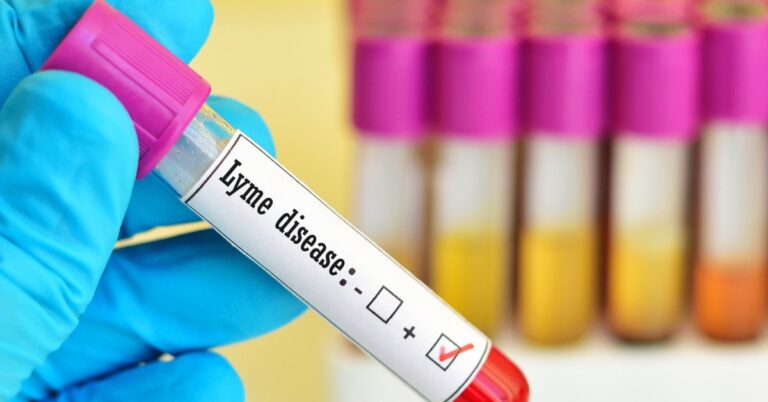 How Long Does Lyme Disease Last? Timeline from Bite to Recovery