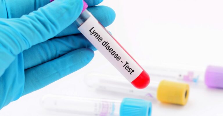 Why Lyme Disease Is Often Misdiagnosed