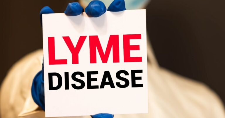 Lime Disease Is Real And No, It’s Not Just a Misspelling